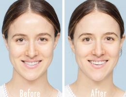 Erno Laszlo Firmarine Mask Before and After | Dermstore Blog