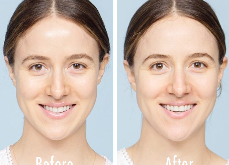 Erno Laszlo Firmarine Mask Before and After | Dermstore Blog